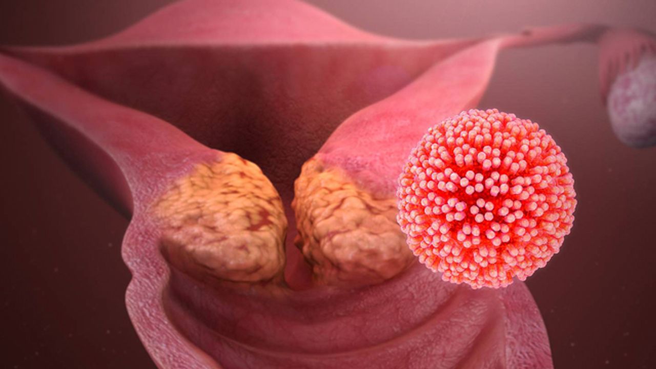 HPV nedeniyle görülen genital siğillere dikkat