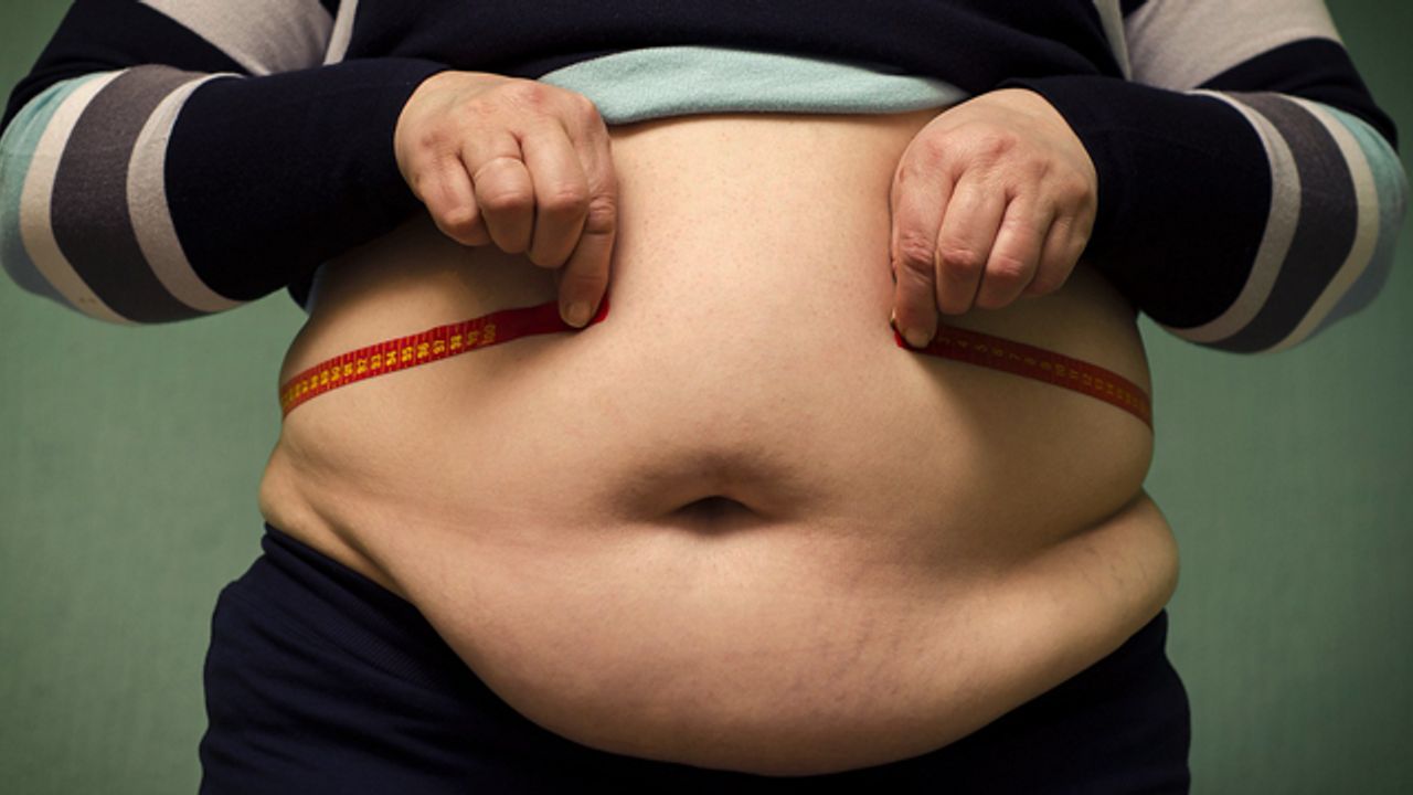 Devlet Hastanesi'nde obezite ameliyatı olmak mümkün