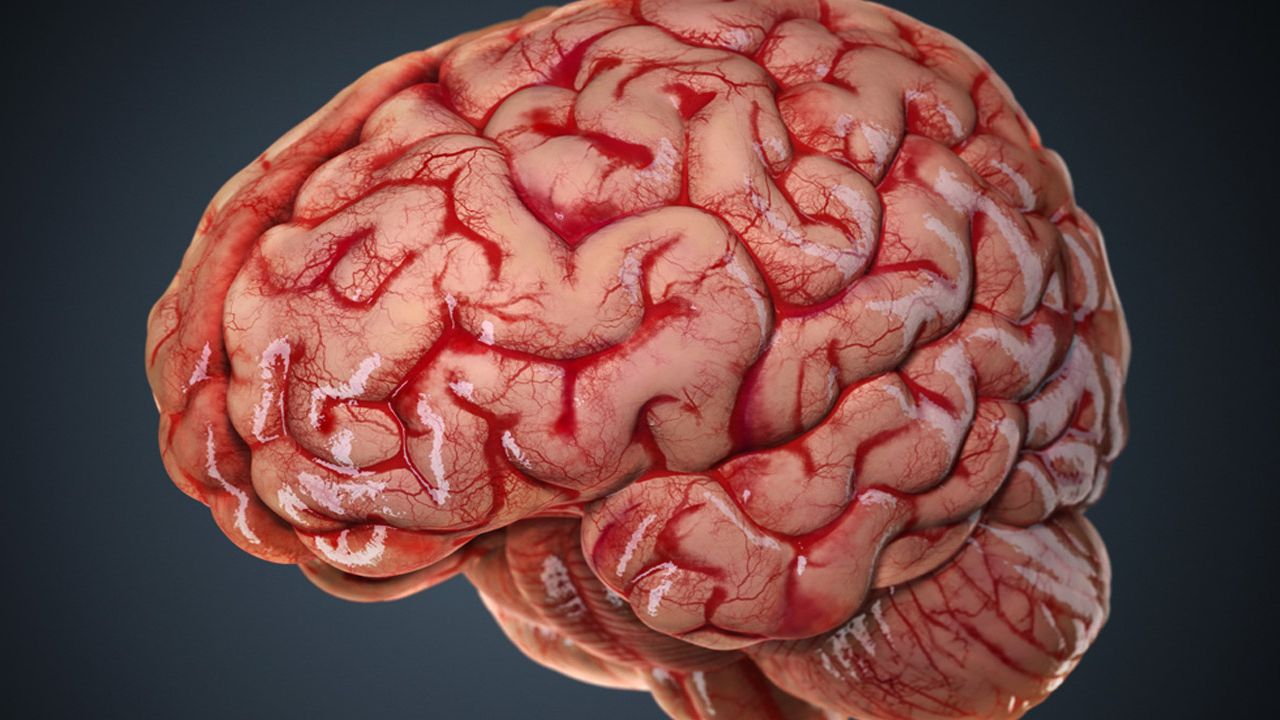 yüksek tansiyonun neden olduğu beyin kanaması