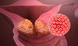 HPV nedeniyle görülen genital siğillere dikkat