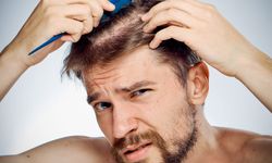 Saç dökülmesine karşı PRP ve mezoterapi