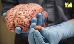Beyin tümörünün en önemli belirtileri nelerdir?