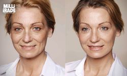 Kırışıklık tedavisinde dermatologlar uyarıyor