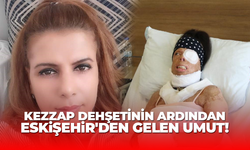 Kezzap dehşetinin ardından Eskişehir'den gelen umut!