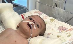 Nefessiz Doğan Bebeğe Mucize Ameliyat!