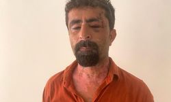 Öfkeli damat kayınpederini hastanelik etti
