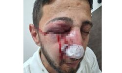 Düğün eğlencesi kabusa döndü: Sağ gözünden oldu