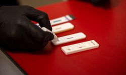 Büyükşehir’den kimliksiz ve ücretsiz test hizmeti