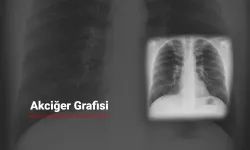 Akciğer röntgeni ciğerlerin yalnızca yüzde 70’ini gösteriyor
