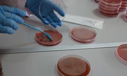 Çiğ süt, gıdayla bulaşan idrar yolu enfeksiyonlarına kapı açıyor