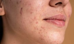 Tek ürünle maksimum fayda: Chia tohumu mucizesi!