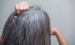 Aynadaki beyazları dert etmeyin! Genç yaşta saç ağarmasının altında yatan 6 gizli sebep!