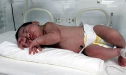 Bebeklerde Folik Asitin Önemi: Sağlıklı Gelişim ve Hayati Faydaları Hakkında Bilmeniz Gerekenler