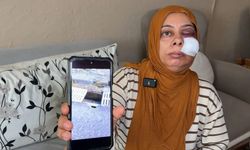 Açık logar kapağı dehşet saçtı!