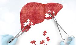 Hepatit Sinsi İlerleyebiliyor: Erken Tanı Hayati Önem Taşıyor