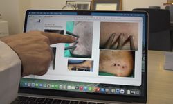 Eskişehir’de Tıp Dünyasını Sarsan Buluş: Dünyada Bir İlk Başarıldı!