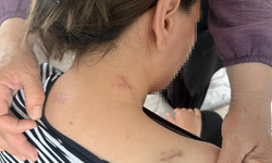 17 Bıçak Darbesi Alan Kadının Dehşet Anları: "Ölü Numarasıyla Kurtuldum"