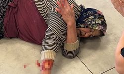 Köpek Saldırısına Uğrayan Kadının Kolu Koptu!