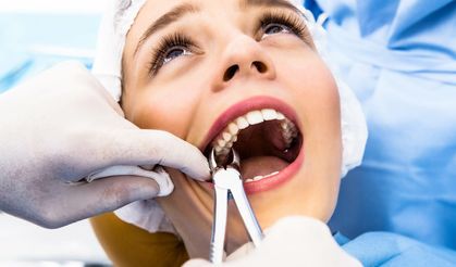 Uzmanlar yirmilik diş çekimi konusunda uyarıyor