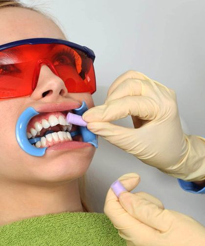 Diş beyazlatma ağrılı bir işlem mi? İşte cevabı