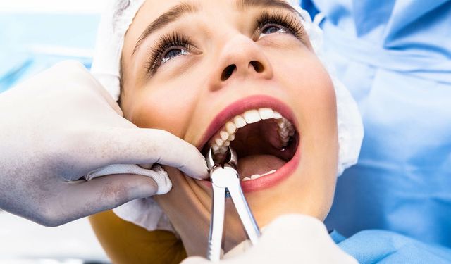 Uzmanlar yirmilik diş çekimi konusunda uyarıyor