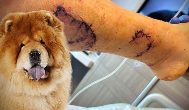 Çin Aslanı, kıskançlıktan sahibinin bacağını parçaladı