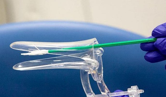 Çoğu Kadın Ancak Geç Kaldığında Öğreniyor: 5 Dakikalık Smear Testi Hayat Kurtarabilir, Neden Önemli ve Kimler Yaptırmalı