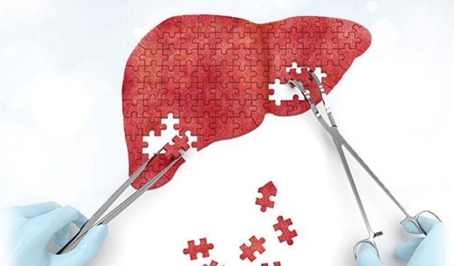 Hepatit Sinsi İlerleyebiliyor: Erken Tanı Hayati Önem Taşıyor