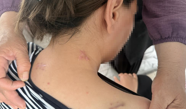 17 Bıçak Darbesi Alan Kadının Dehşet Anları: "Ölü Numarasıyla Kurtuldum"