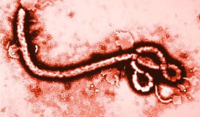 Ebola Hakkında Bilmeniz Gereken Tüm Hayati Gerçekler