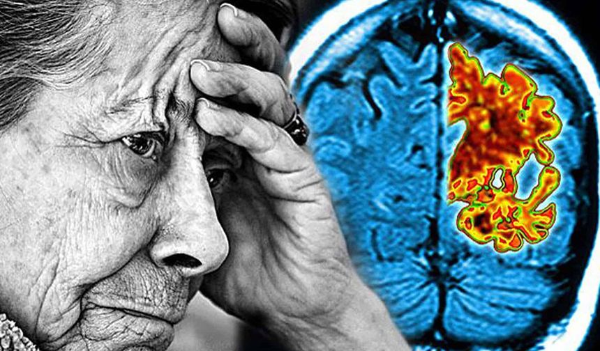 Herpes Virüsü, Alzheimer'ın Gelişimiyle Bağlantılı Olabilir