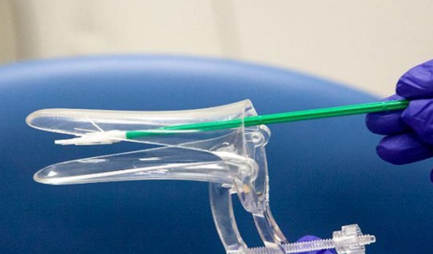 Çoğu Kadın Ancak Geç Kaldığında Öğreniyor: 5 Dakikalık Smear Testi Hayat Kurtarabilir, Neden Önemli ve Kimler Yaptırmalı