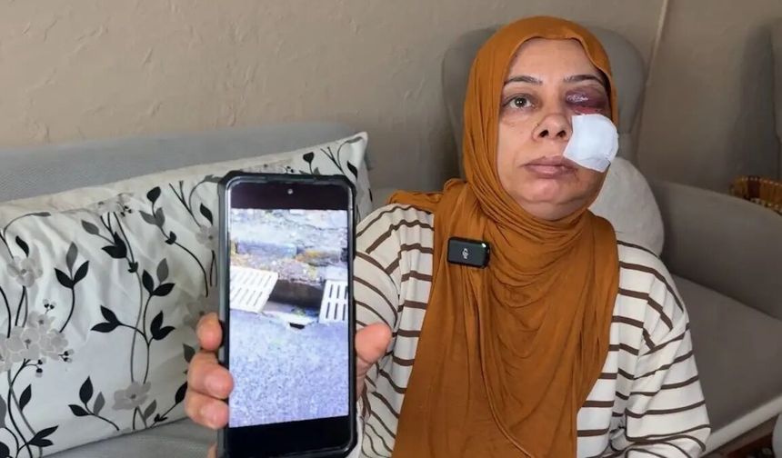 Açık logar kapağı dehşet saçtı!