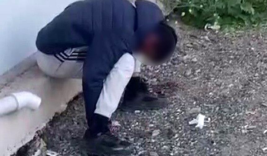"Zombi" Görüntüleri Polisi Harekete Geçirdi