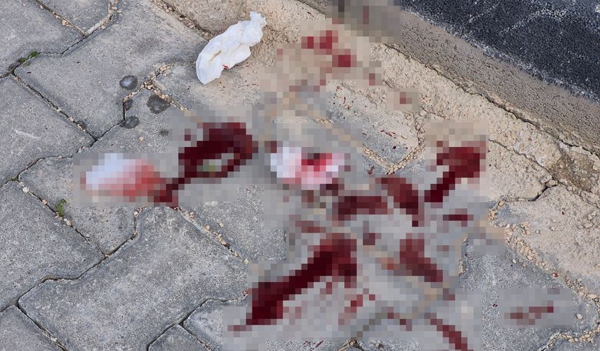 Eskişehir’de Cadde Ortasında Çocuğa Bıçaklı Saldırı