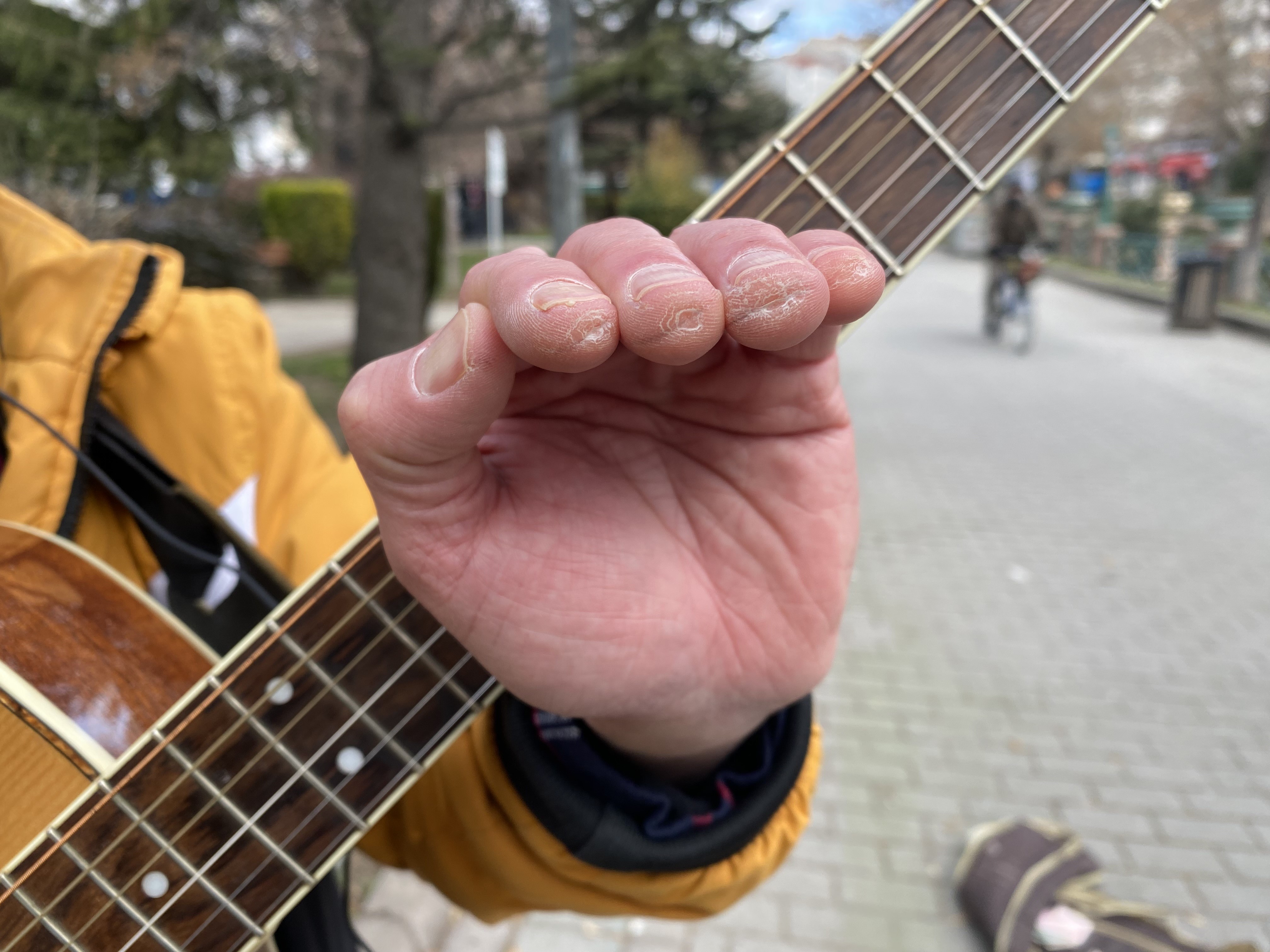 Aynı Anda Hem Mızıka Hem De Gitar Çalıyor (2)