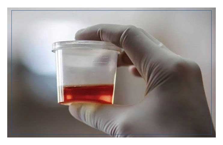 İş Başvurularında Yeni Dönem: Şirketler Artık "Madde Testi" Şartı Koşuyor!