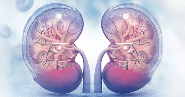 Böbrek Sağlığınız İçin Kritik Uyarı