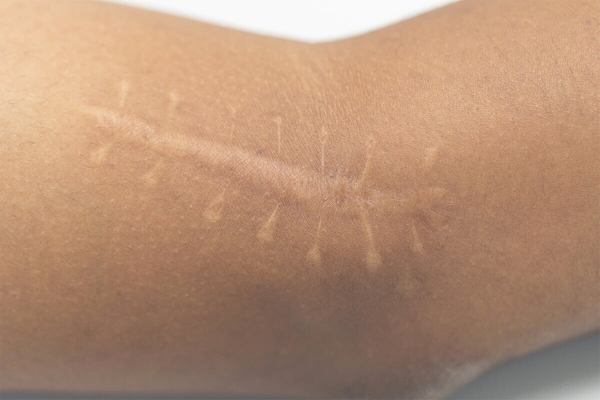 Uzmanlardan "Kök Neden" Uyarısı!