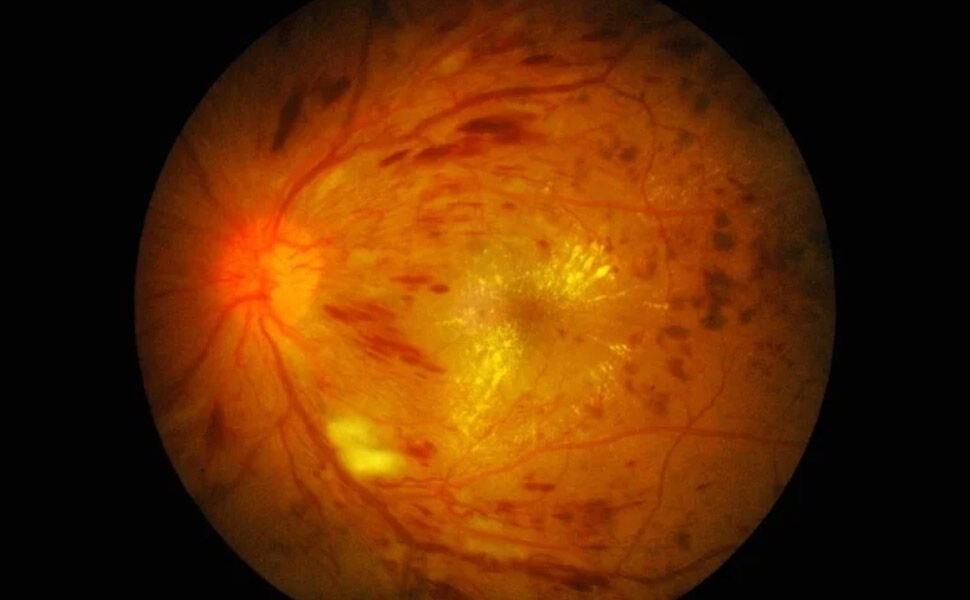 Gizli Hastalıkların 4 Büyük İşareti!