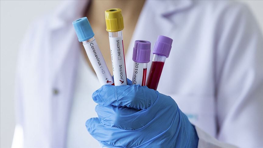 Covid-19’un Gizemi Çözüldü mü?