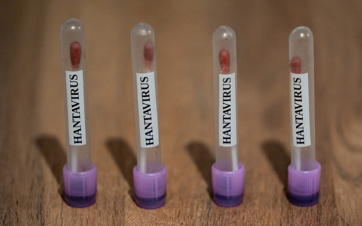 Hantavirus 
