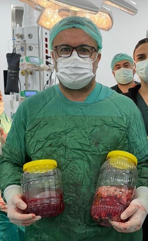 doktor, hasta, tümör