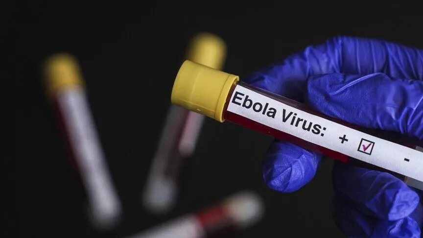 Dsö'den Açıklama Kdc'de Ebola Salgını Yayılıyor