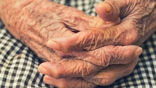 Alzheimer Hastalığı